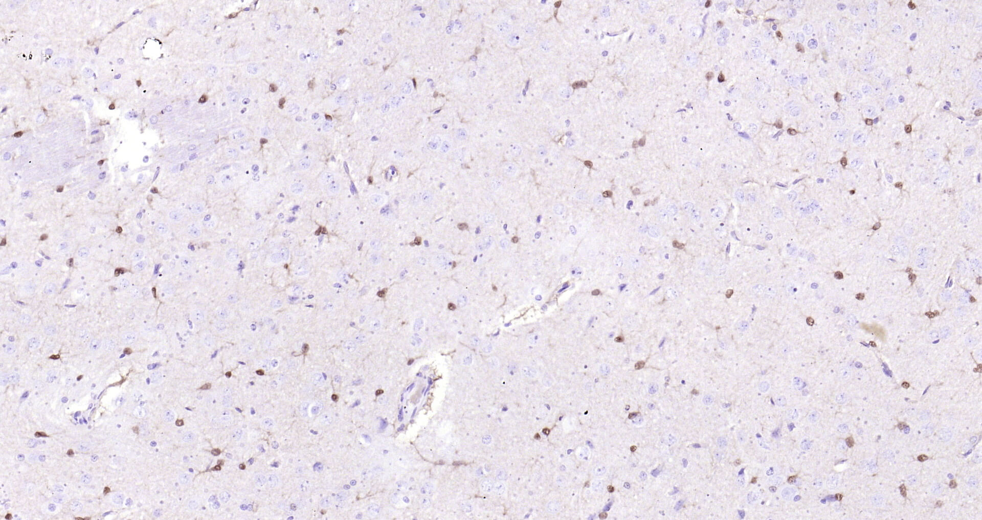 蛋白单克隆即用型免疫组化试剂盒-IHC0110